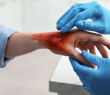 Wound Infection