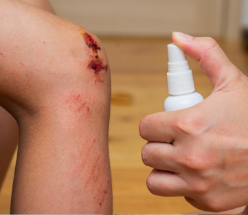 Wound Cleansers & Wound Management Principles
