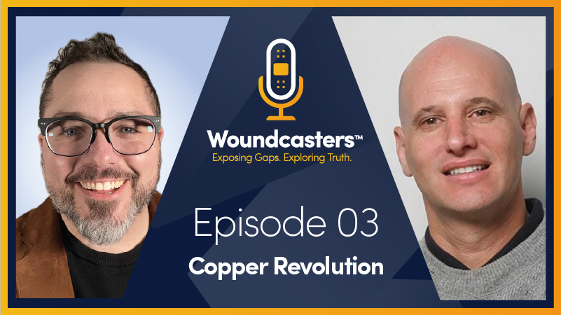 Woundcasters | Ep.03 The Copper Revolution